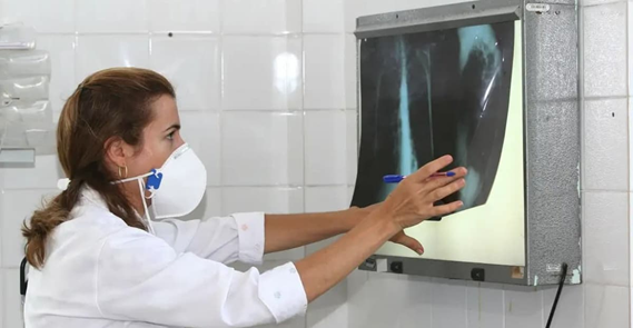 Ministério da Saúde anuncia distribuição de 70 mil medicamentos para tratar tuberculose na Bahia